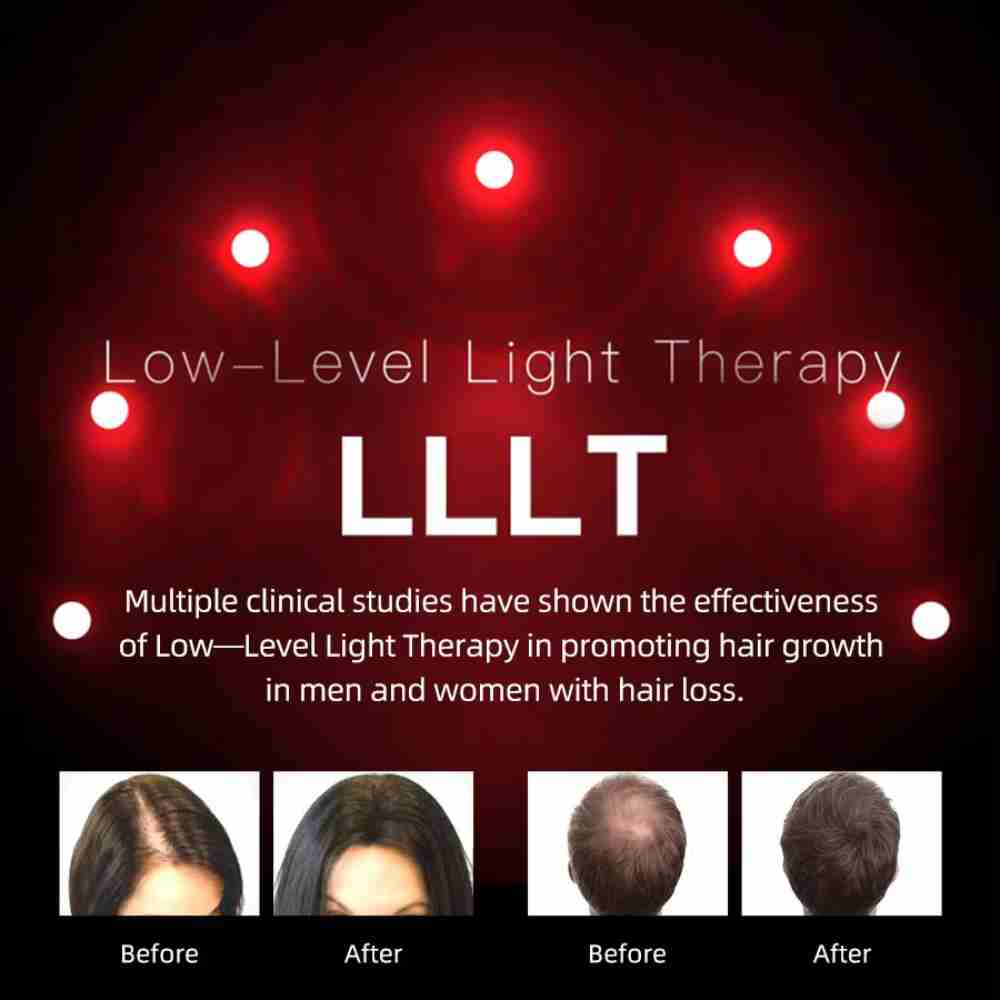 Valenluma Latest Technology Laser Hair Growth Helmet for Hair Loss Treatment