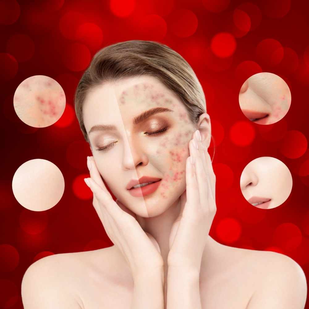 Valenluma Red Light Face Mask Facial Silicone Near Infrared Led Light Therapy Mask Red Light Face and Neck Mask