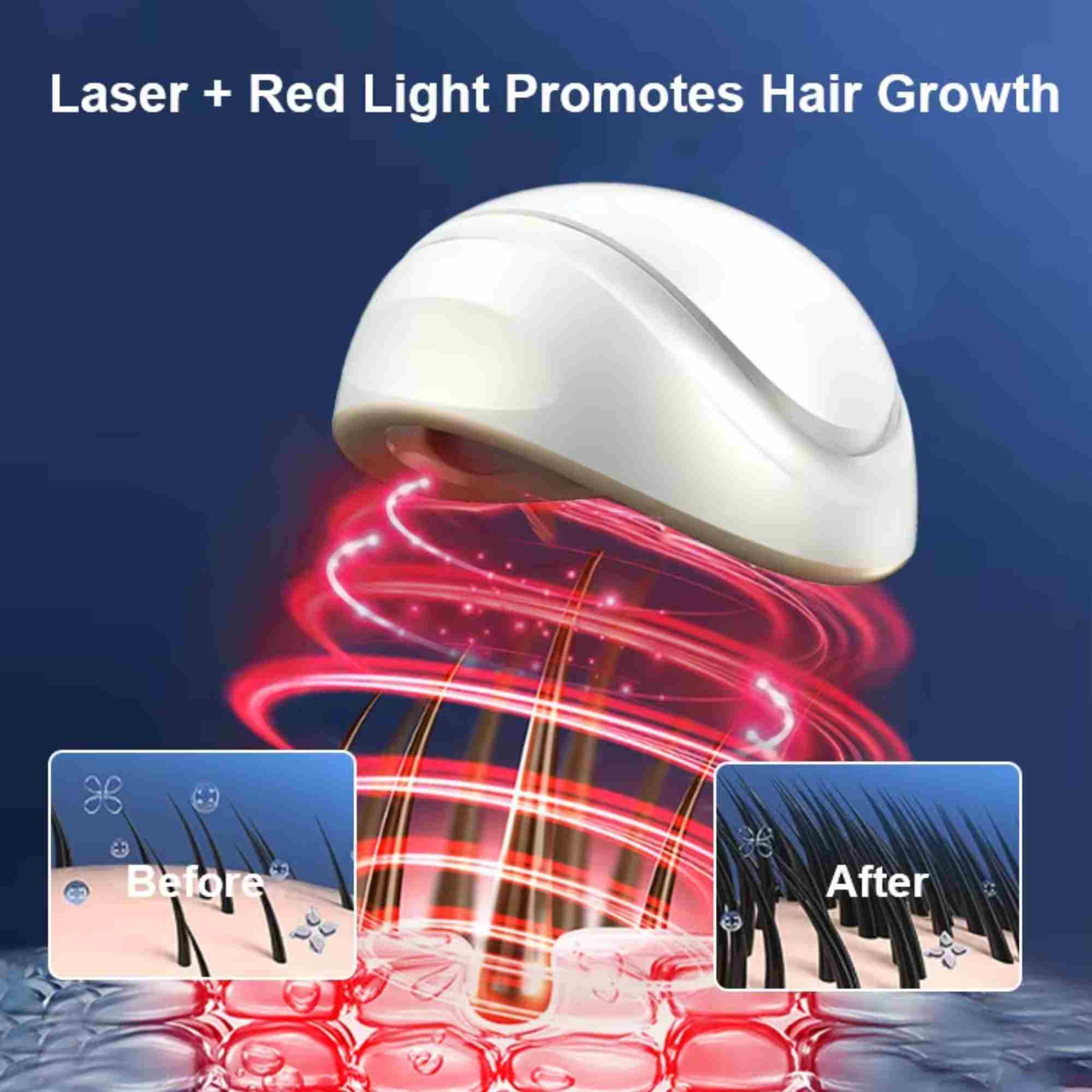 Valenluma Led Hair Growth Helmet Red Light Therapy  Laser Hair Growth Treatment