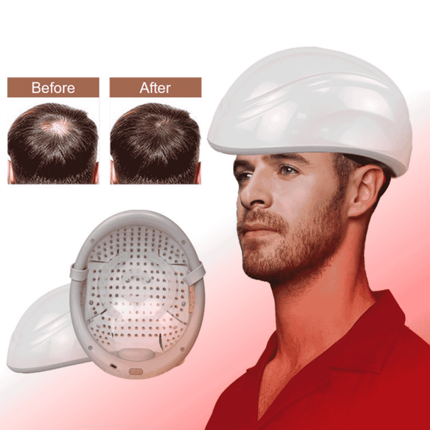 Valenluma Laser  Red Light therapy Helmet Scalp Hair Care Laser PDT Therapy High Power LLLT Hair Grow Device
